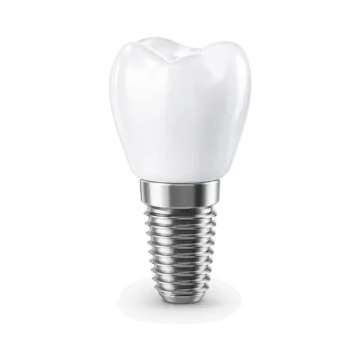 Representação de implante e prótese dentária.